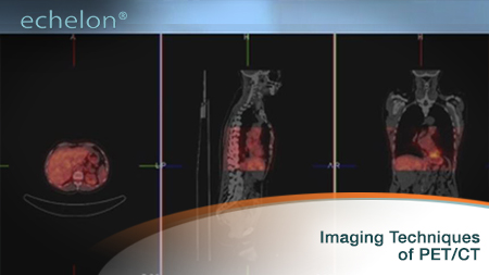 Online Courses | echelon